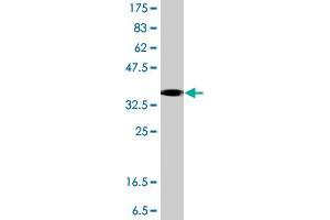 Western Blot detection against Immunogen (37. (Angiomotin 抗体  (AA 361-460))