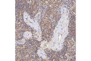 IHC analysis of SGCE using anti-SGCE antibody (ABIN7601544). (SGCE 抗体  (AA 38-407))