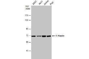 Western Blotting (WB) image for anti-Plastin 3 (PLS3) antibody (ABIN2855613)