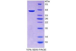 SDS-PAGE (SDS) image for Keratin 3 (KRT3) (AA 198-514) protein (His tag) (ABIN2125559) (Keratin 3 Protein (KRT3) (AA 198-514) (His tag))
