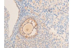 ABIN6267219 at 1/100 staining rat ovarian tissue sections by IHC-P.