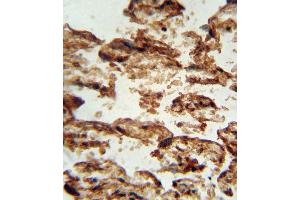 IGFBP4 antibody (Center) (ABIN652262 and ABIN2841131) immunohistochemistry analysis in formalin fixed and paraffin embedded human placenta tissue followed by peroxidase conjugation of the secondary antibody and DAB staining. (IGFBP4 抗体  (AA 96-124))