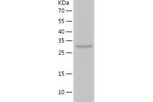 TERT Protein (AA 595-928) (His tag)