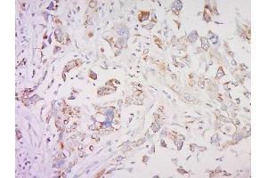 Immunohistochemistry (Paraffin-embedded Sections) (IHC (p)) image for anti-SMAD, Mothers Against DPP Homolog 1 (SMAD1) (AA 151-250) antibody (ABIN4914138)