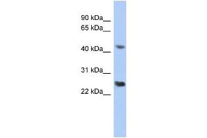 WB Suggested Anti-RYBP Antibody Titration:  0. (RYBP 抗体  (Middle Region))