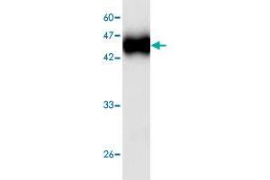 Western blot analysis in cgd7_4540 recombinant protein with cgd7_4540 monoclonal antibody, clone 55d68  at 1 : 1000 dilution. (CP15/60 Sporozoite 60K Protein 抗体  (AA 9-156))