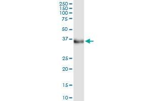 Immunoprecipitation of ETV7 transfected lysate using anti-ETV7 MaxPab rabbit polyclonal antibody and Protein A Magnetic Bead , and immunoblotted with ETV7 MaxPab mouse polyclonal antibody (B01) . (ETV7 抗体  (AA 1-341))