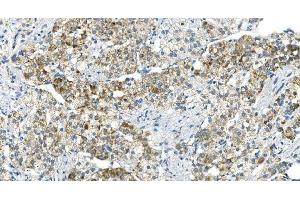 IHC analysis of DR6/TNFRSF21 using anti-DR6/TNFRSF21 antibody (ABIN7603008).