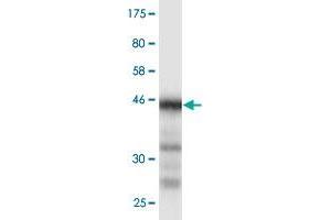 Western Blotting (WB) image for anti-Protein Phosphatase 1, Regulatory (Inhibitor) Subunit 1B (PPP1R1B) (AA 1-168) antibody (ABIN529586)