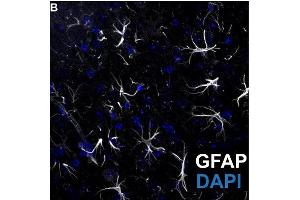 Representative image of GFP positive (white, cat. (GFAP 抗体  (AA 411-422))