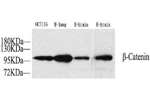 Western Blot analysis of various samples using Catenin beta Polyclonal Antibody at dilution of 1:1000. (beta Catenin 抗体)