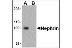 Western blot analysis in mouse kidney tissue lysate using Nephrin Antibody at 1 μg/ml in the (A) absence and (B) presence of blocking peptide. (Nephrin 抗体  (C-Term))