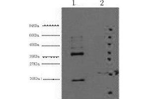 Western Blot analysis of 1) Hela, 2) 293T cells using CA9 Monoclonal Antibody at dilution of 1:5000. (CA9 抗体)