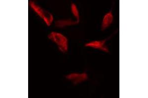 ABIN6274756 staining HeLa cells by IF/ICC. (RPS4X 抗体  (Internal Region))