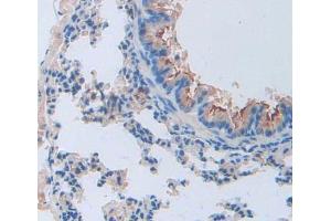 Used in DAB staining on fromalin fixed paraffin- embedded lung tissue (Cathepsin W 抗体  (AA 22-371))