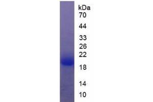 SDS-PAGE analysis of Rat Thyroid Peroxidase Protein. (Thyroperoxidase 蛋白)