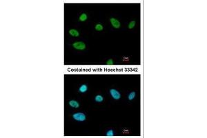 ICC/IF Image Immunofluorescence analysis of paraformaldehyde-fixed A549, using SOX2, antibody at 1:200 dilution. (SOX2 抗体)