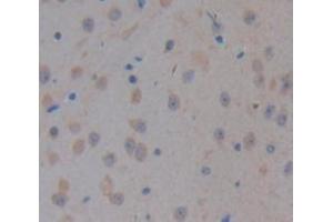 Used in DAB staining on fromalin fixed paraffin-embedded kidney tissue (CELSR3 抗体  (AA 942-1175))