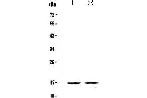 Western blot analysis of Galectin 10 using anti-Galectin 10 antibody .