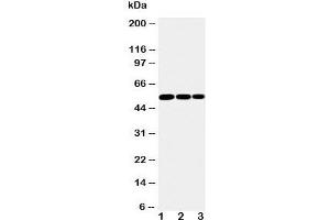 Western blot testing of IKK gamma antibody and Lane 1:  mouse liver;  2: mouse brain;  3: mouse ovary tissue lysate. (IKBKG 抗体  (N-Term))