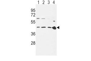 Western Blotting (WB) image for anti-Chemokine (C-C Motif) Receptor 7 (CCR7) antibody (ABIN3002197) (CCR7 抗体)