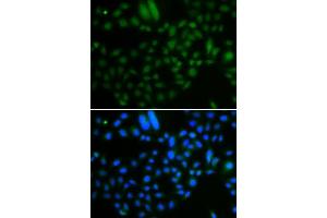 Immunofluorescence analysis of A549 cells using ALKBH8 antibody. (ALKBH8 抗体  (AA 1-230))
