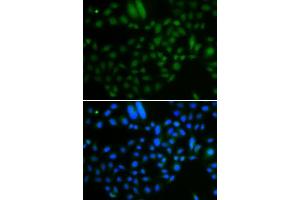 Immunofluorescence analysis of A549 cells using ALKBH8 antibody.