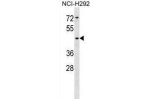 Western Blotting (WB) image for anti-Sialic Acid Binding Ig-Like Lectin 14 (SIGLEC14) antibody (ABIN5018304) (SIGLEC14 抗体)