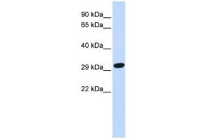 SDCBP antibody used at 1 ug/ml to detect target protein. (SDCBP 抗体)