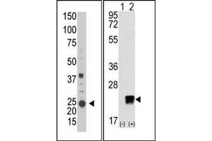 Image no. 1 for anti-ADP-Ribosylation Factor-Like 3 (ARL3) (C-Term) antibody (ABIN357652) (ARL3 抗体  (C-Term))