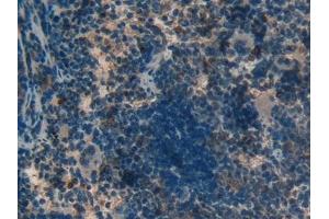 Immunohistochemistry (IHC) image for anti-Mitochondrially Encoded NADH Dehydrogenase 5 (MT-ND5) (AA 425-562) antibody (ABIN7437398)