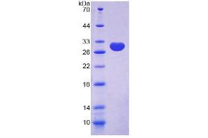 SDS-PAGE analysis of Human C/EBP delta Protein. (CEBPD 蛋白)