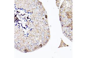 Immunohistochemistry (IHC) image for anti-Sal-Like 4 (SALL4) (AA 853-1053) antibody (ABIN7270138)