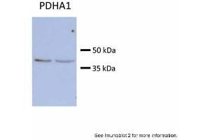 Sample type:Huh7 HepG2 (50ug)Primary Antibody Dilution: 1:500Image Submitted by: Partha KasturiUniversity of Kansas Medical Center