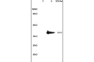 Lane 1: mouse heart lysates Lane 2: mouse brain lysates probed with Anti ADORA2B Polyclonal Antibody, unconjugated (ABIN759536) at 1:200 in 4 °C Followed by conjugation to secondary antibody (ABIN727474-HRP) at 1:3000 90min in 37 °C Predicted band 39kD. (Adenosine A2b Receptor 抗体  (AA 101-200))
