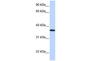 WB Suggested Anti-LCN12 Antibody Titration: 0. (LCN12 抗体  (N-Term))