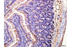 Immunohistochemistry (Paraffin-embedded Sections) (IHC (p)) image for anti-Solute Carrier Family 11 (Proton-Coupled Divalent Metal Ion Transporters), Member 2 (SLC11A2) (AA 251-350) antibody (ABIN701065)