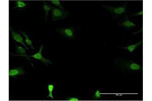Immunofluorescence of monoclonal antibody to DCK on HeLa cell. (DCK 抗体  (AA 161-260))