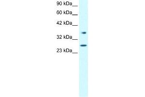 WB Suggested Anti-FOXA3 Antibody Titration:  0. (FOXA3 抗体  (Middle Region))