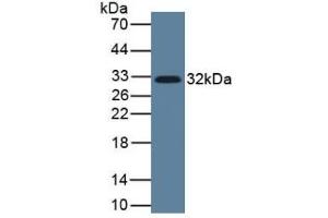 Mouse Detection antibody from the kit in WB with Positive Control: Human Lung Tissue.