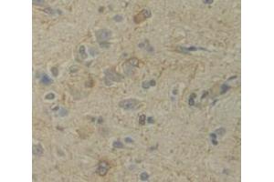 Immunohistochemistry (IHC) image for anti-Semaphorin 7A, GPI Membrane Anchor (John Milton Hagen Blood Group) (SEMA7A) (AA 242-507) antibody (ABIN1860528)