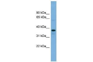 VPS16 antibody used at 0. (VPS16 抗体  (N-Term))