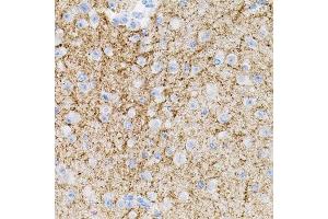 Immunohistochemistry of paraffin-embedded mouse brain using NTF3 antibody. (Neurotrophin 3 抗体  (AA 19-257))