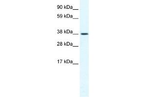 Western Blotting (WB) image for anti-Transient Receptor Potential Cation Channel, Subfamily M, Member 3 (TRPM3) (N-Term) antibody (ABIN630089)