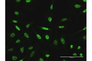 Immunofluorescence of purified MaxPab antibody to GTF3C2 on HeLa cell. (GTF3C2 抗体  (AA 1-911))
