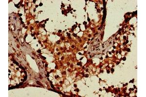 Immunohistochemistry of paraffin-embedded human testis tissue using ABIN7154406 at dilution of 1:100 (CSF2RA 抗体  (AA 23-320))