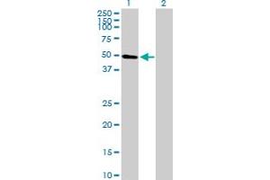 Western Blot analysis of ARID5A expression in transfected 293T cell line by ARID5A MaxPab polyclonal antibody. (ARID5A 抗体  (AA 1-430))