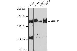 Western blot analysis of extracts of various cell lines, using NUP160 Rabbit pAb (ABIN6133841, ABIN6144957 and ABIN7101841) at 1:3000 dilution. (NUP160 抗体)