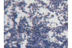 DAB staining on IHC-P; Samples: Rat Lymph node Tissue (ACP6 抗体  (AA 33-413))