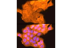 Immunofluorescence analysis of  cells using LORICRIN Rabbit pAb (ABIN7268295) at dilution of 1:200 (40x lens). (LOR 抗体)
